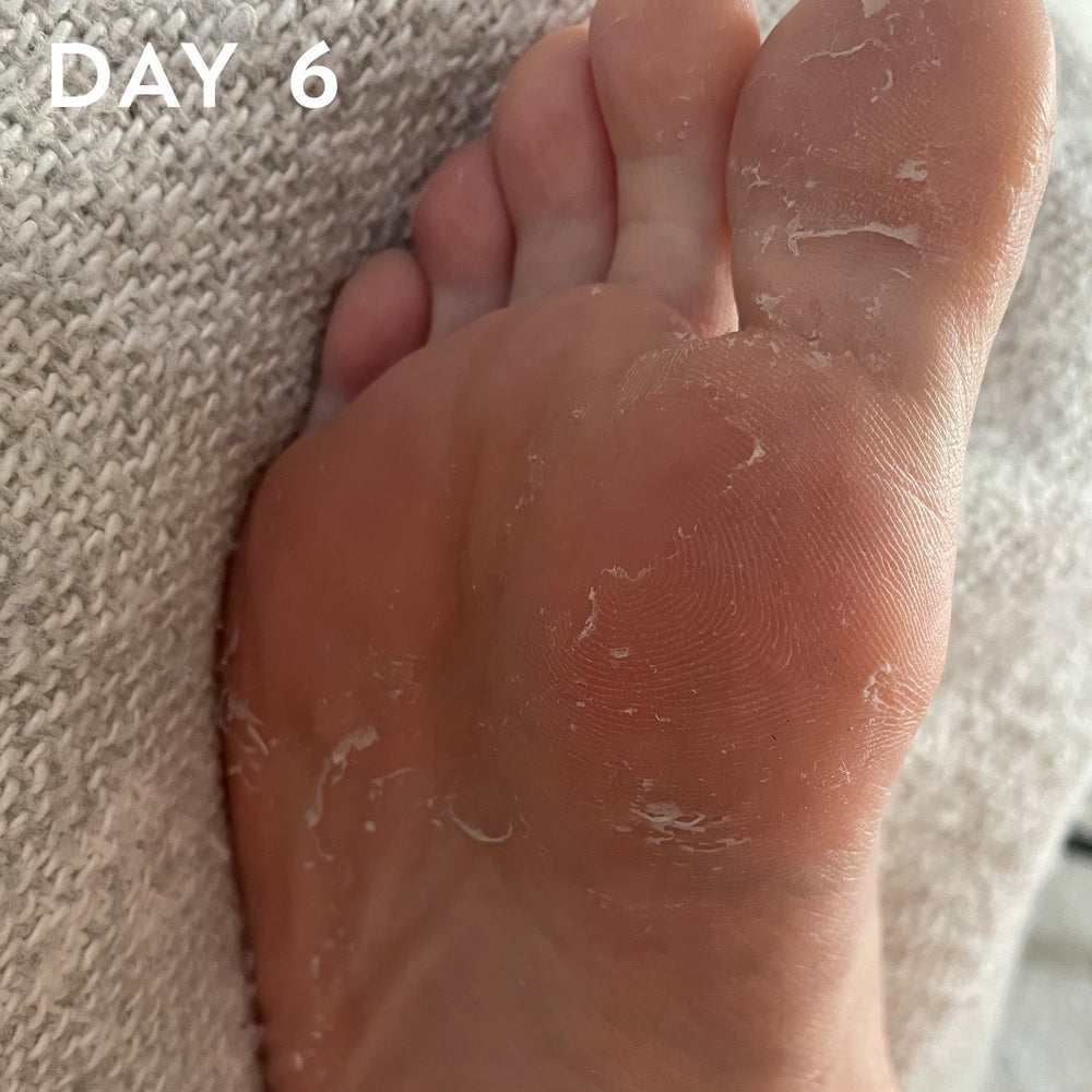 Maskology FOOT PEEL Professional Foot Treatment