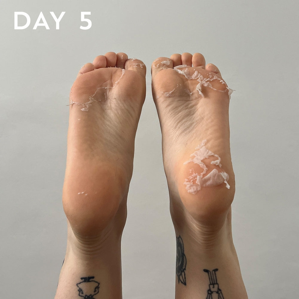 FOOT PEEL Professional Foot Treatment